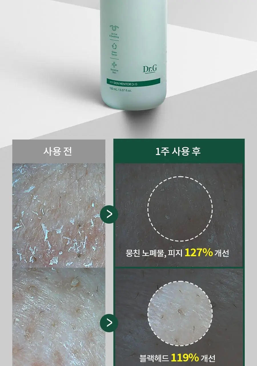 [증정 기획] 닥터지 레드 블레미쉬 포 맨 올인원 오일컷 로션 150ml 기획 (+30ml) 상세페이지 12